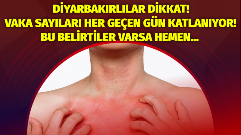 Diyarbakırlılar dikkat! Vaka sayıları her geçen gün katlanıyor! Bu belirtiler varsa hemen…