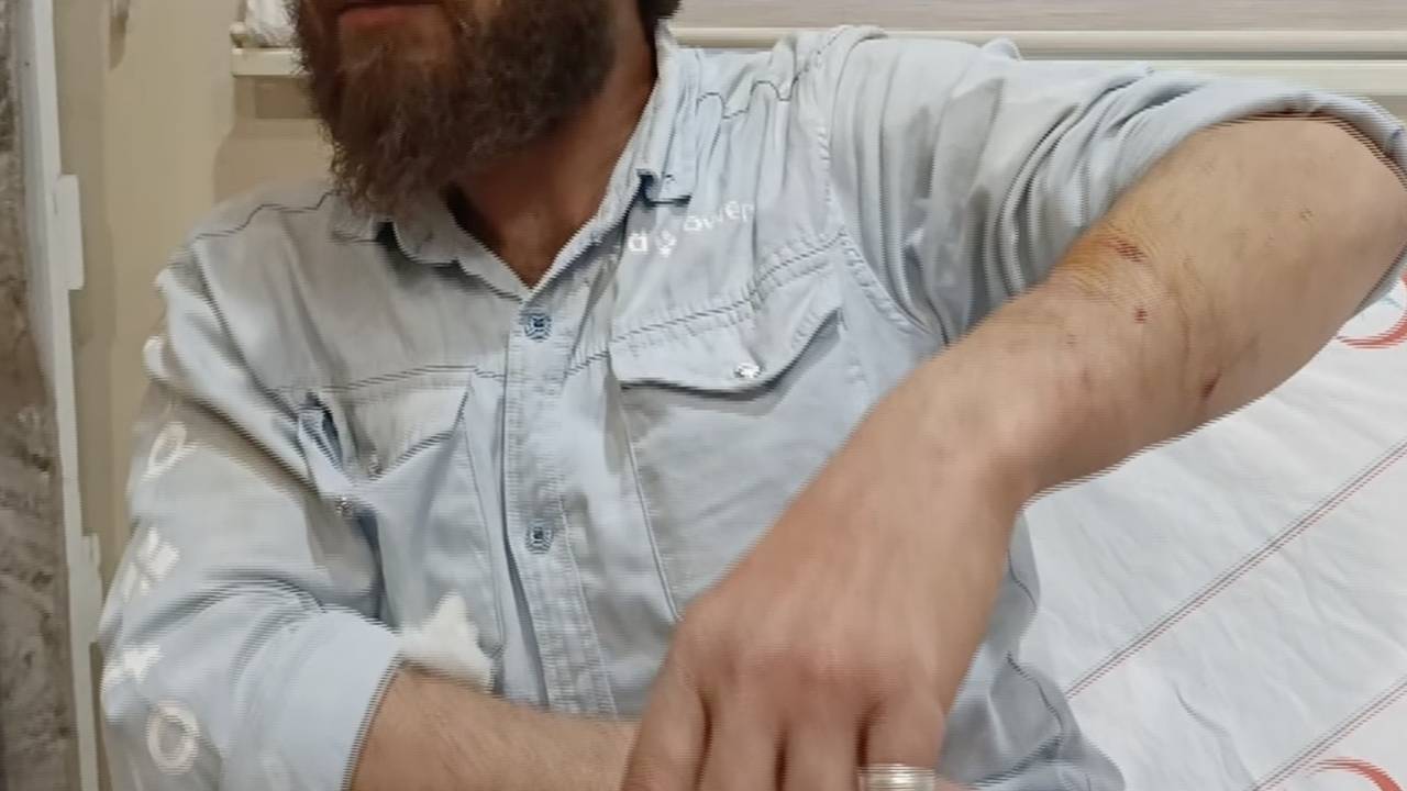 Adıyaman’da sahipli köpek yabancıya saldırdı