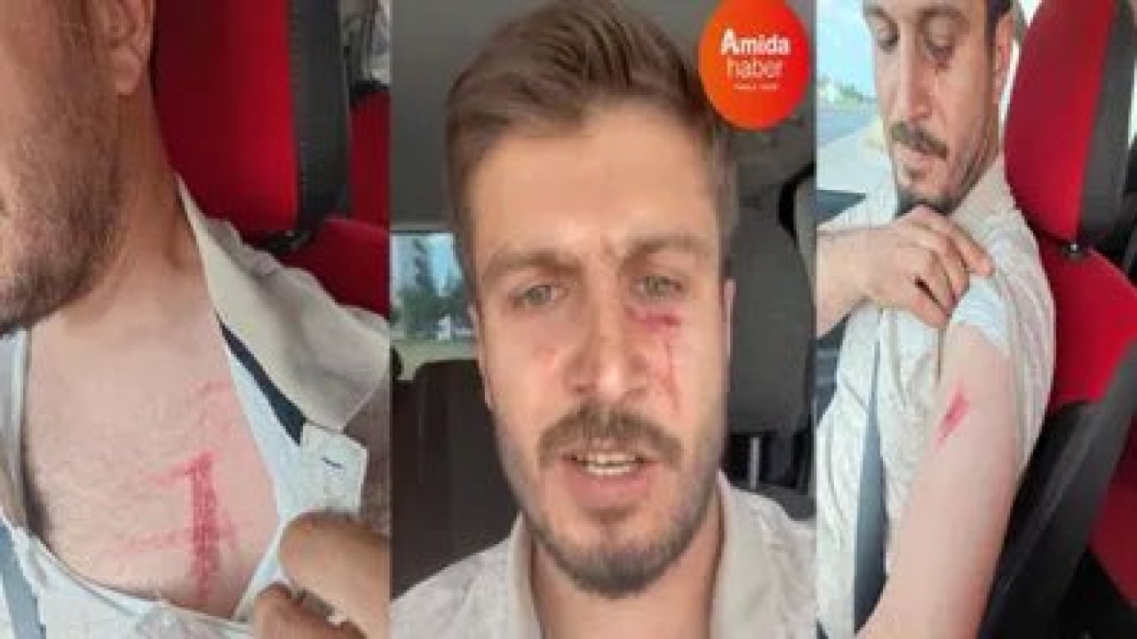 Diyarbakır’da işkence: Polis hasta çocuğunun yanında bu hale getirdi