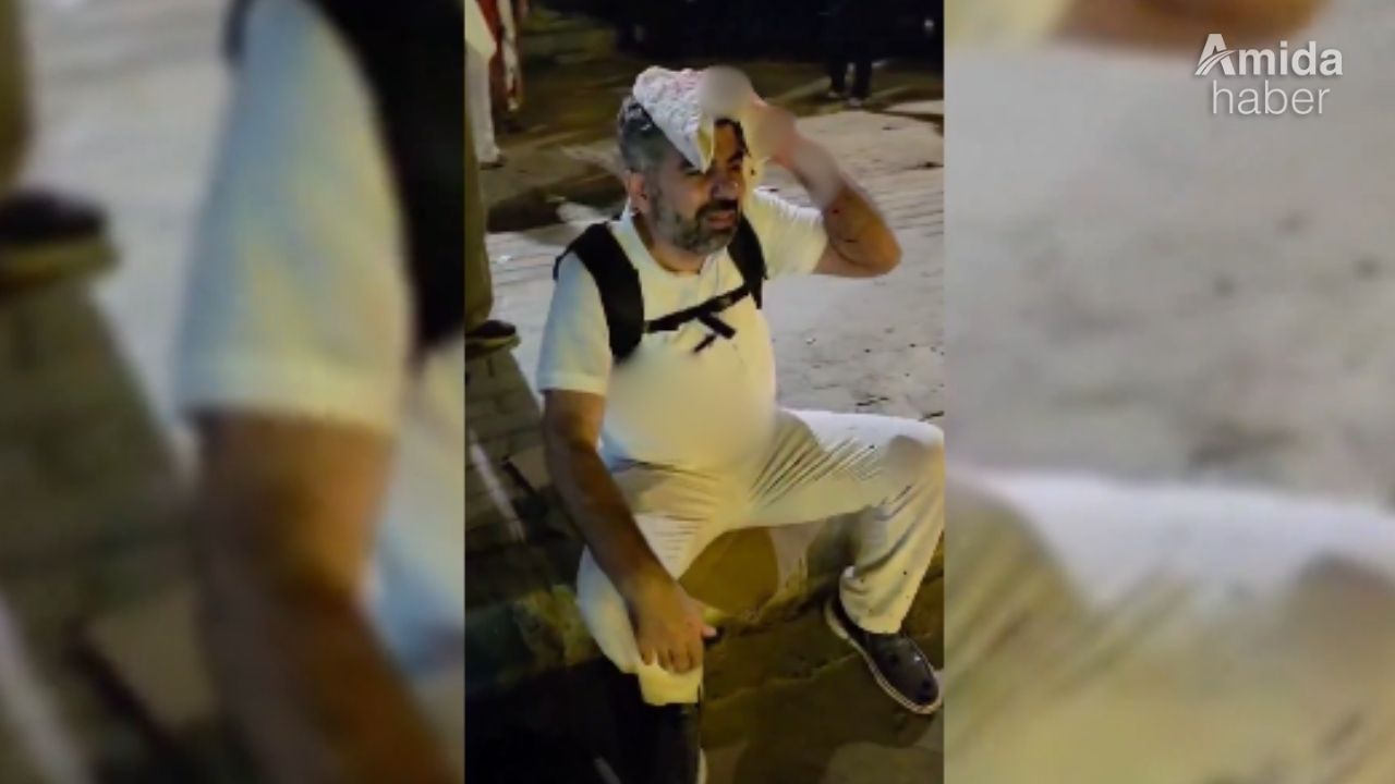 Diyarbakırlı vekil Mısır'da başından yaralandı