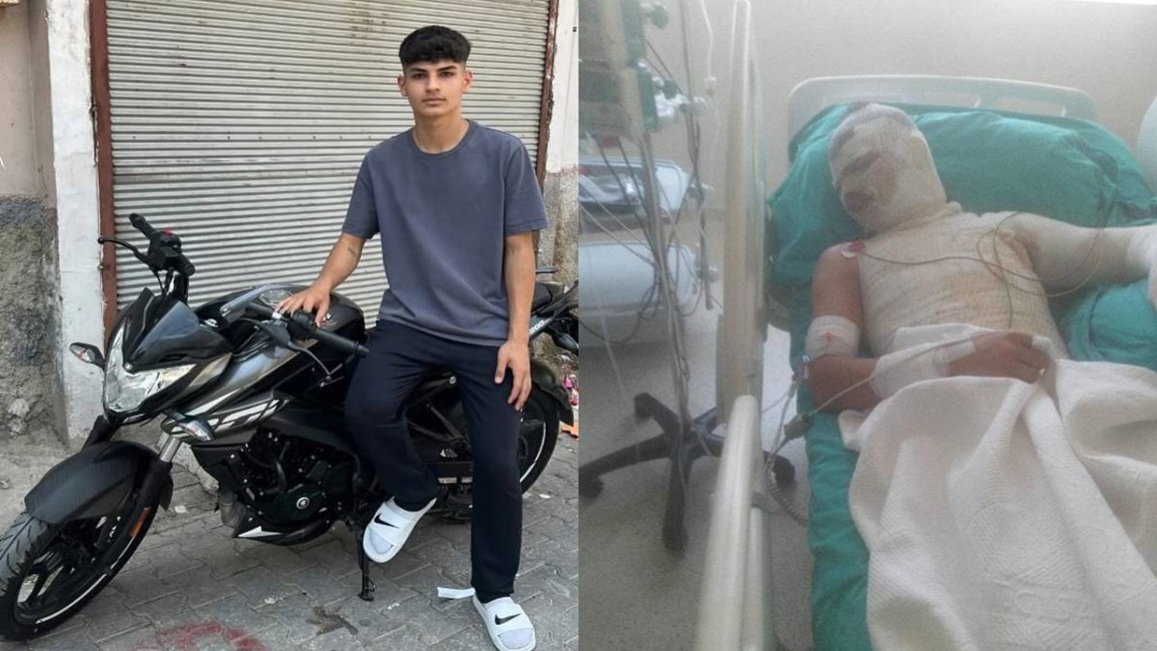 Yeğenini yakan amca suçu babaya attı