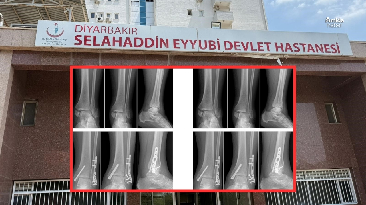 Diyarbakır’da Sağlam kemiğe platin: 2 doktora ihraç talebi