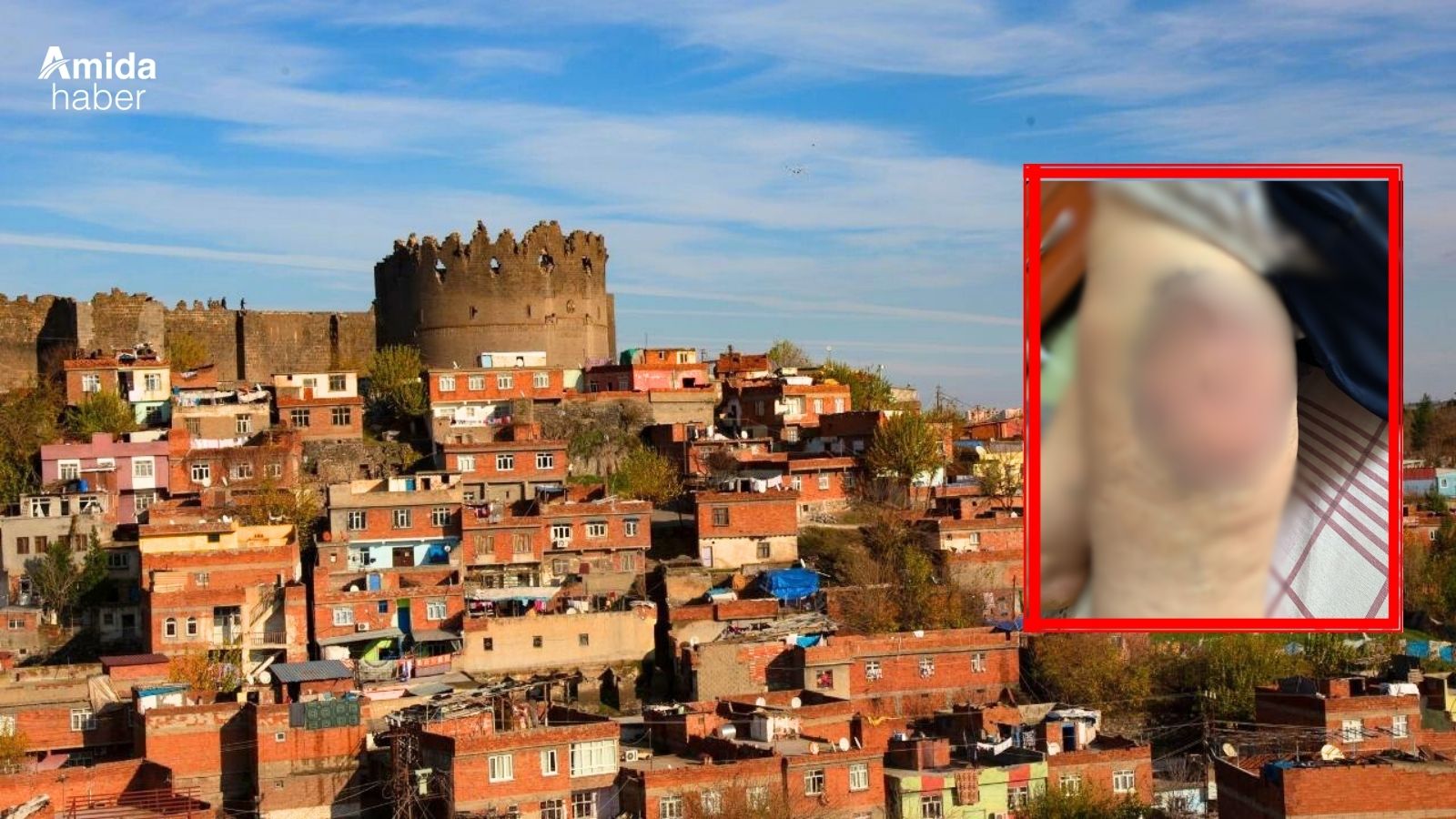 Diyarbakır'da bir kadının ölmeden önceki son feryadı