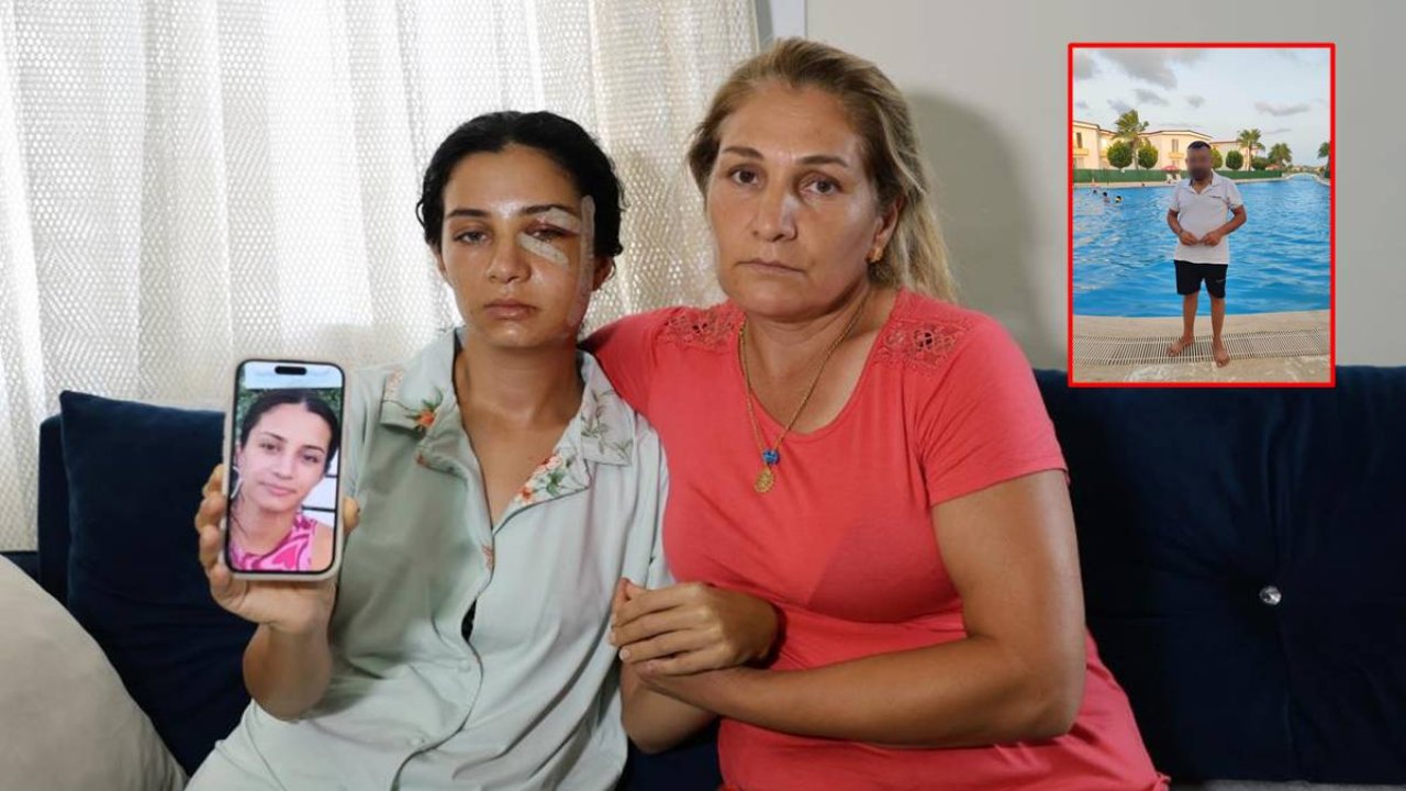 Eski eş şiddeti: Önce serbest kaldı, tepkiler sonrası tutuklandı
