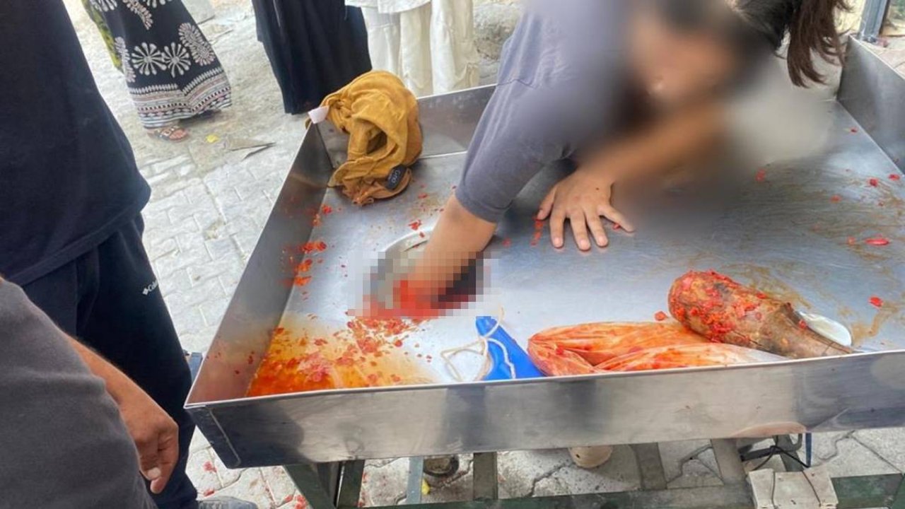 16 yaşındaki çocuk elini salça makinesine kaptırdı