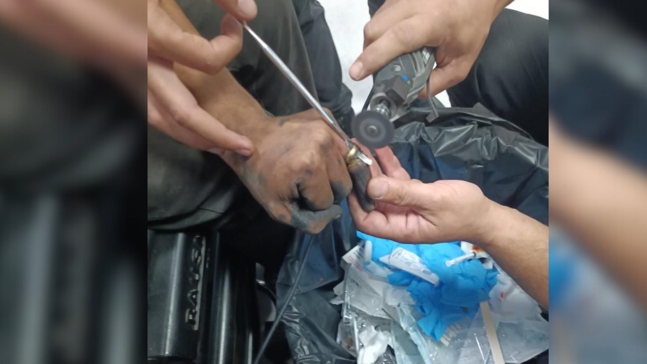 Batman’da yüzük parmağında sıkıştı: Ekipler seferber oldu