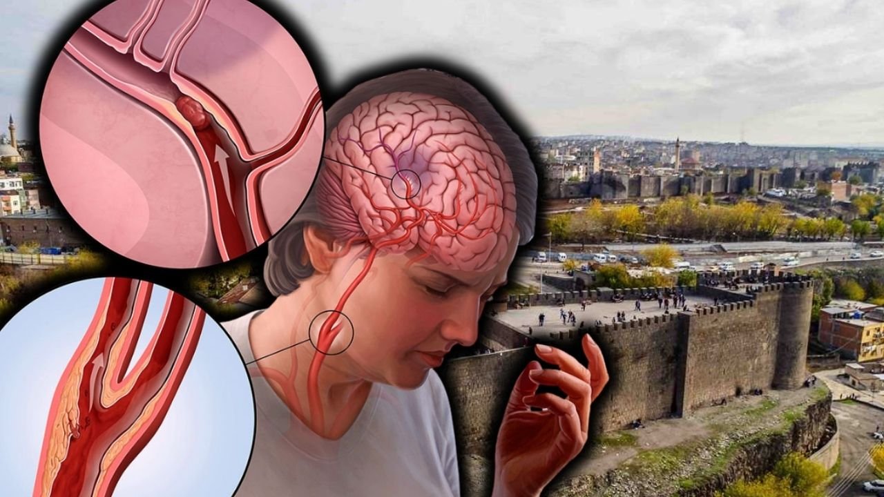 Diyarbakır’da uzmandan uyarı: İnme’ye dikkat!