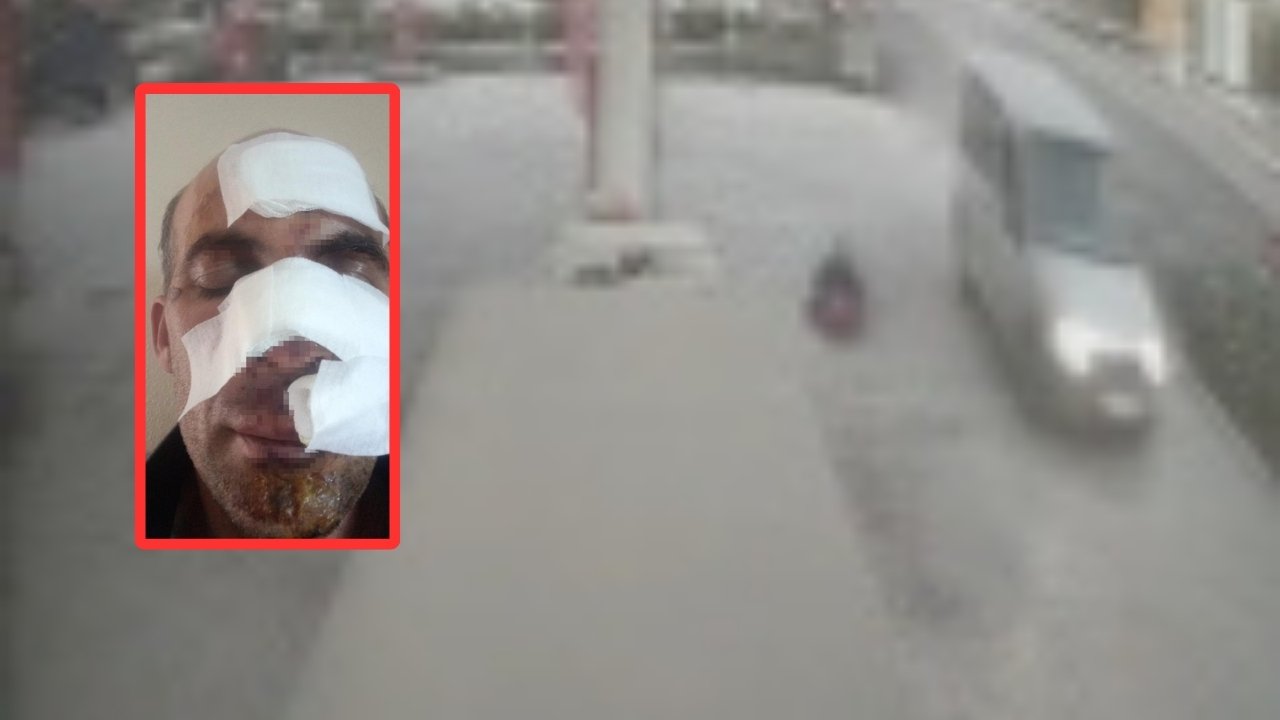 Eniştesine arabayla çarpıp olay yerinden kaçtı