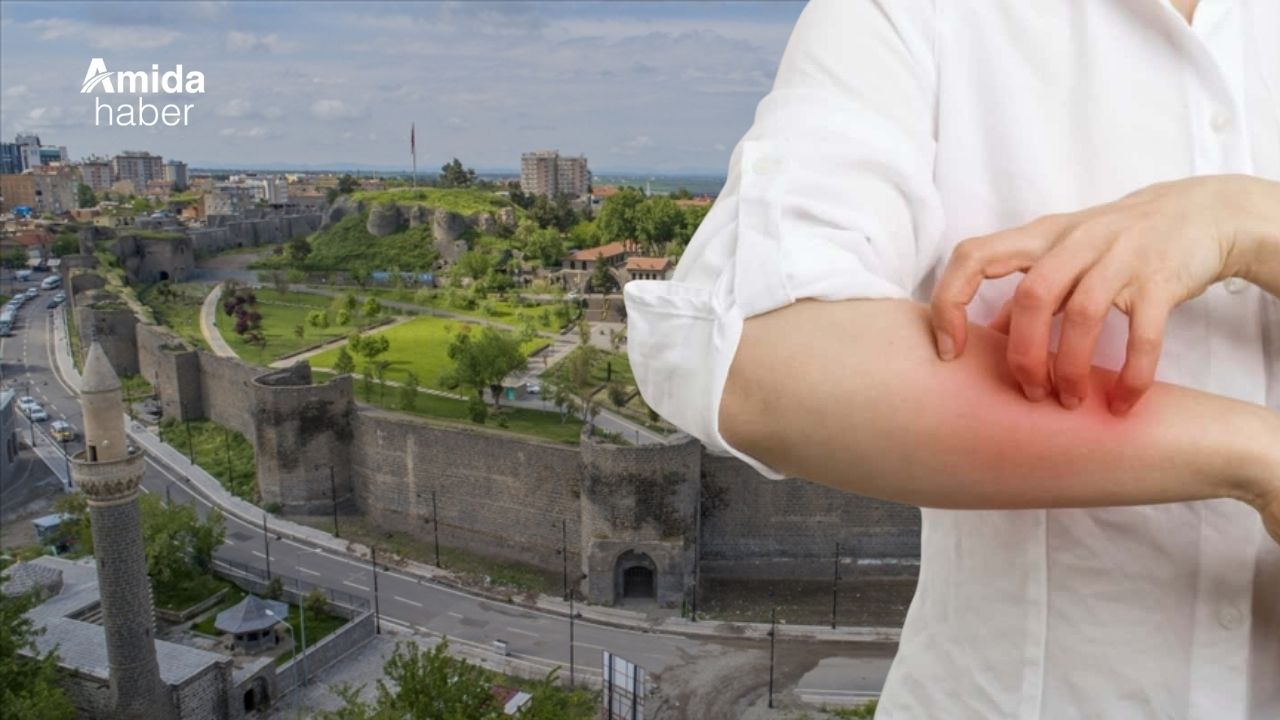 Diyarbakır’da ‘bit’ salgını: Utanmayın!