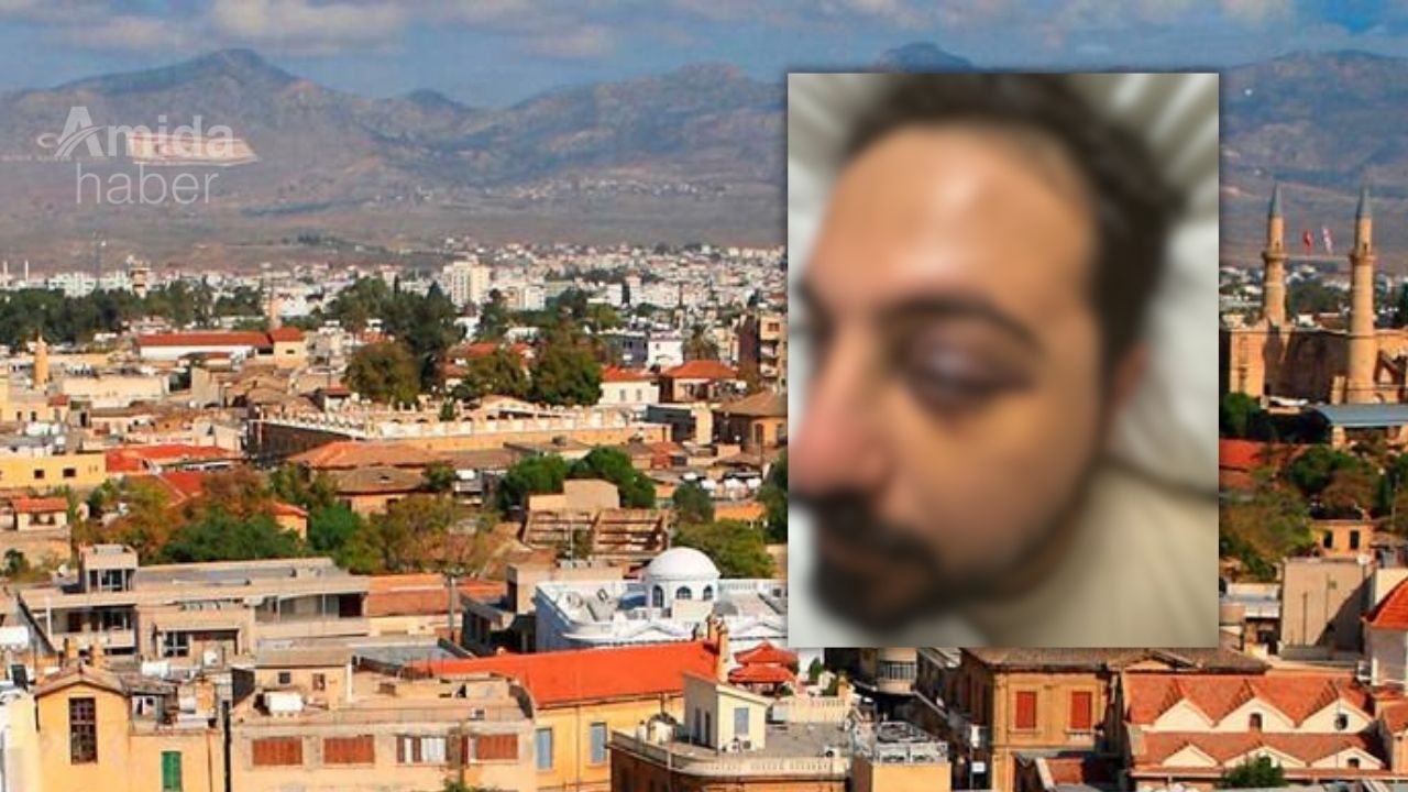 Nusaybinli genç Kıbrıs’ta saldırıya uğradı: Aile adalet çağrısı yaptı