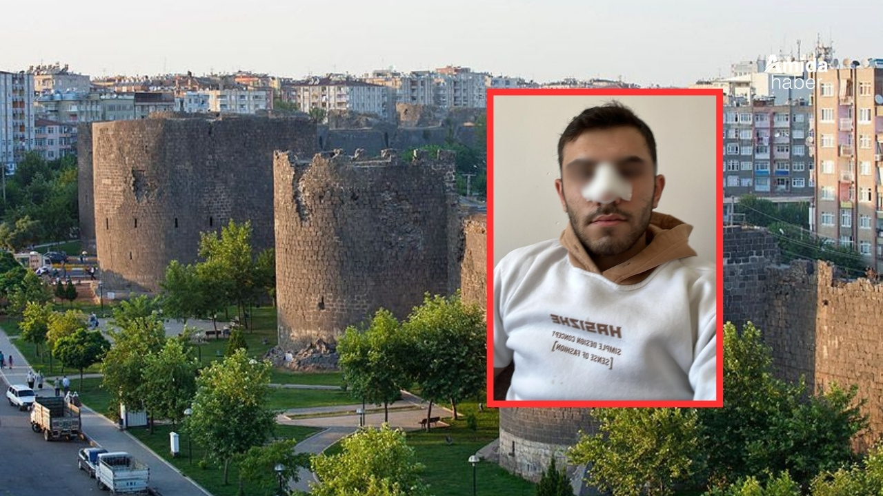 Diyarbakır’da doktor 17 yaşındaki gencin burnunu kırdı
