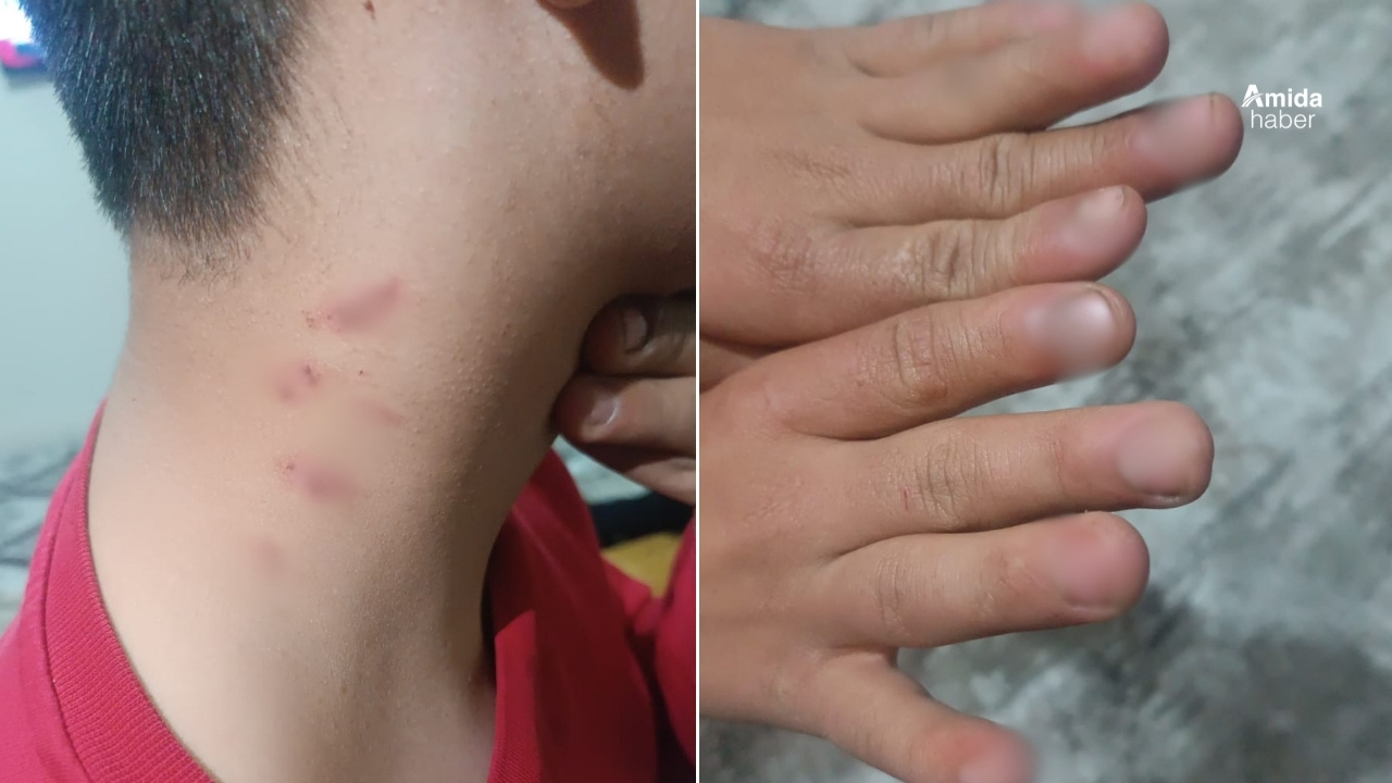 Diyarbakır’da engelli çocuğun babasına yargı şoku!