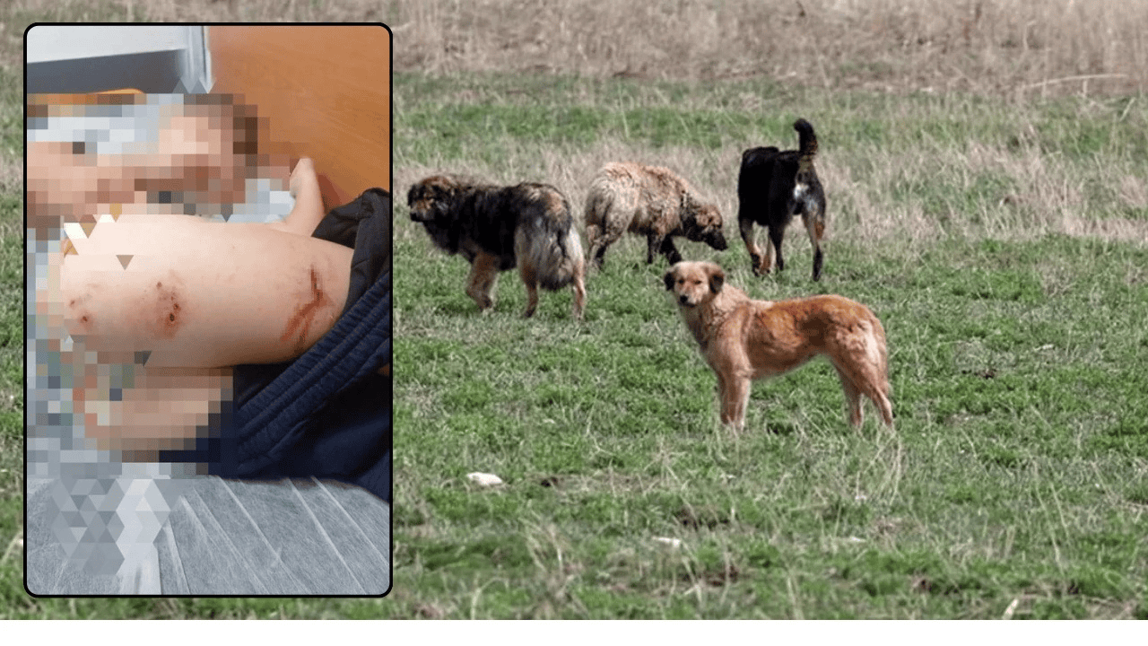 Diyarbakır’da 11 yaşındaki çocuk 10 köpeğin saldırısına uğradı
