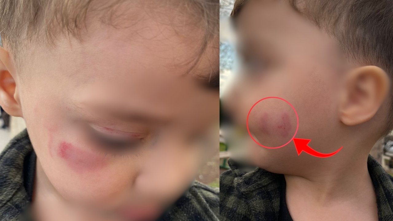 Diyarbakır’daki kreşte şiddet iddiası: Aile şikayetçi oldu