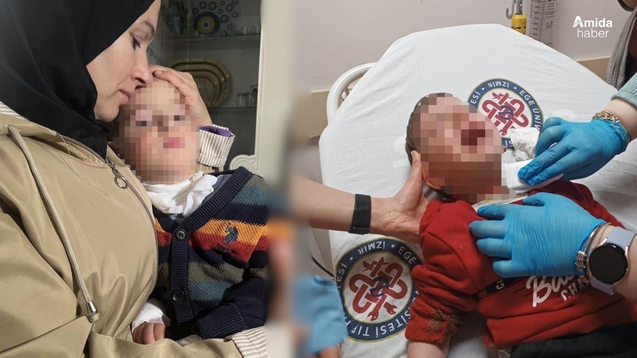 2 yaşındaki çocuğa parkta bıçaklı saldırı