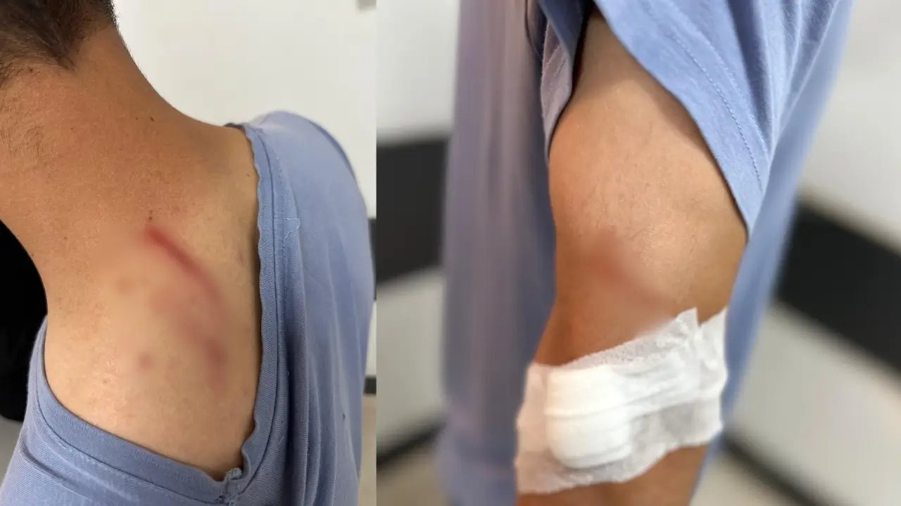 Diyarbakır’da randevu kavgası: Tıbbi sekretere saldırdı