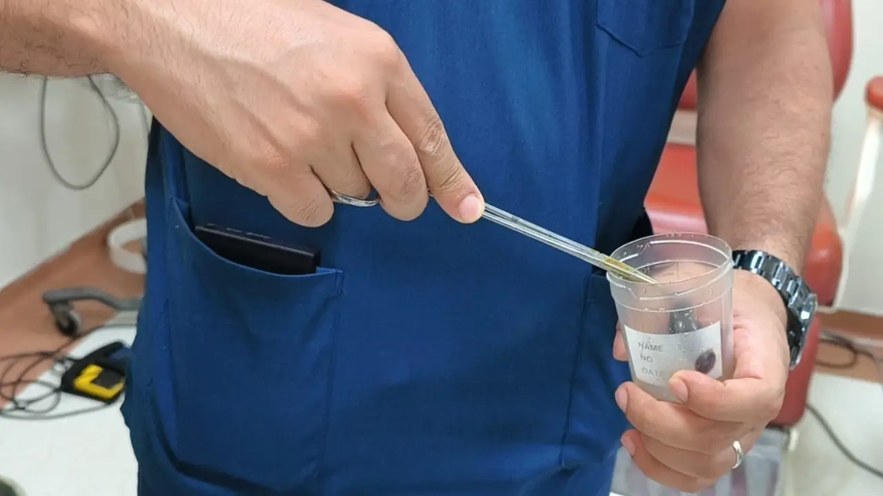 Dere suyu içen çocuğun boğazına sülük yapıştı: Doktordan uyarı