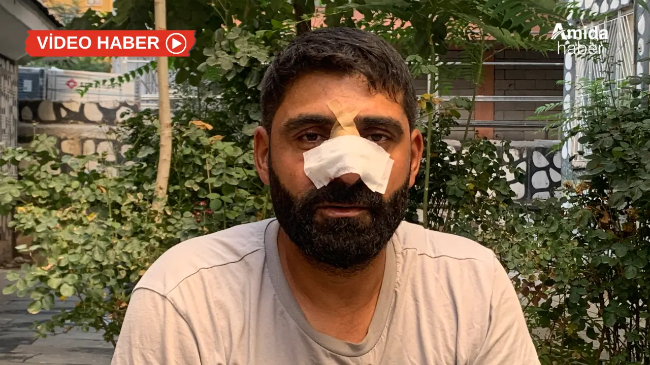 Burnu 5 yerden kırıldı: Nedeni Amedspor forması