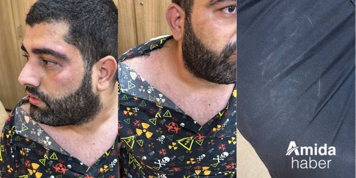 Diyarbakır’da hasta yakınları doktora saldırdı