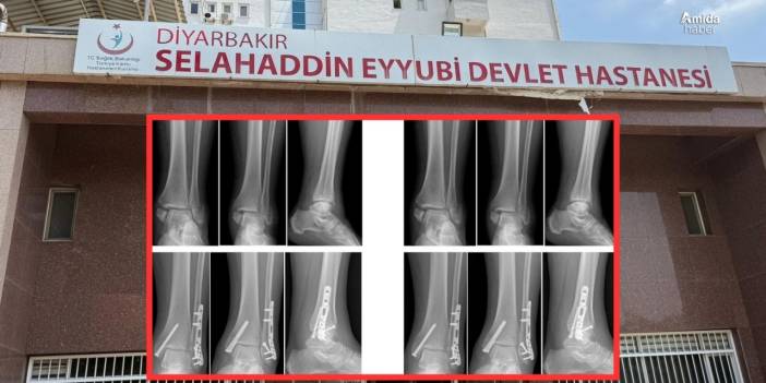 Diyarbakır’da Sağlam kemiğe platin: 2 doktora ihraç talebi