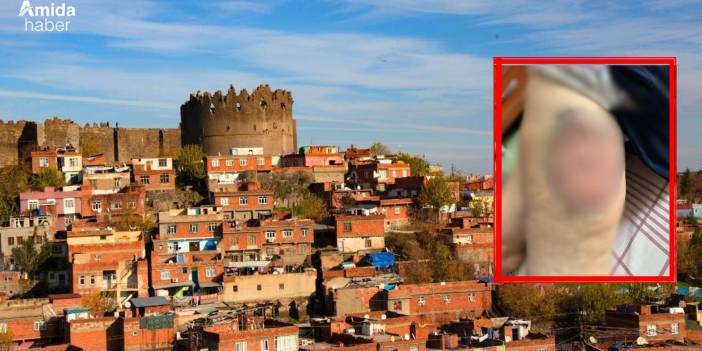 Diyarbakır'da bir kadının ölmeden önceki son feryadı