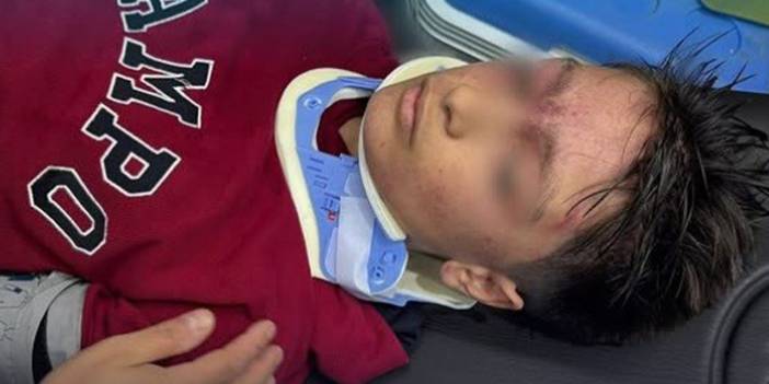 Erzurum'da okul çıkışı 23 öğrenci hastanelik oldu