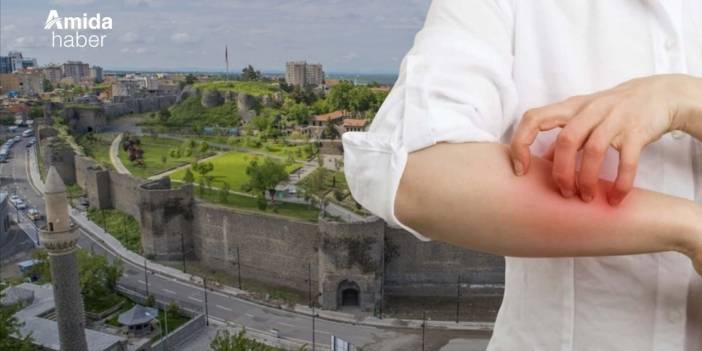 Diyarbakır’da ‘bit’ salgını: Utanmayın!