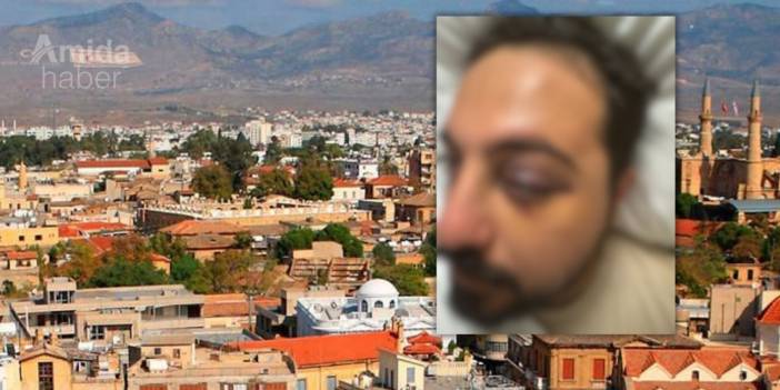 Nusaybinli genç Kıbrıs’ta saldırıya uğradı: Aile adalet çağrısı yaptı
