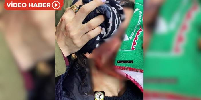 Bodrum’da Amedspor taraftarlarına saldırı