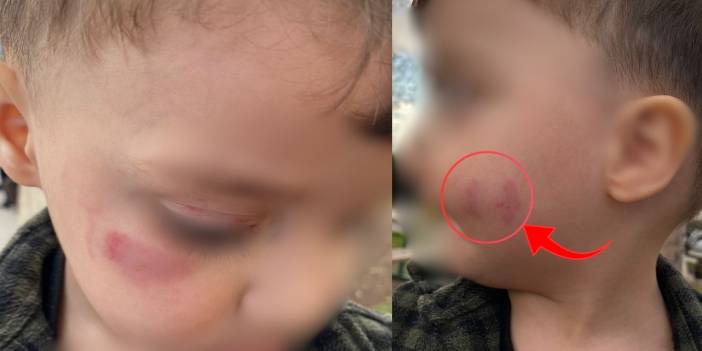 Diyarbakır’daki kreşte şiddet iddiası: Aile şikayetçi oldu