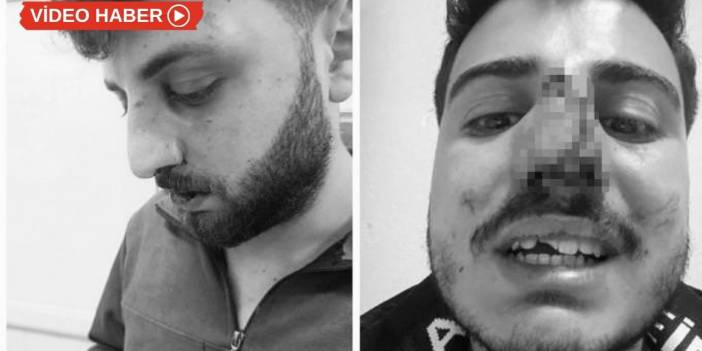 Van Başkale’de ‘3 gence polis darp’ iddiası: Soruşturma başlatıldı