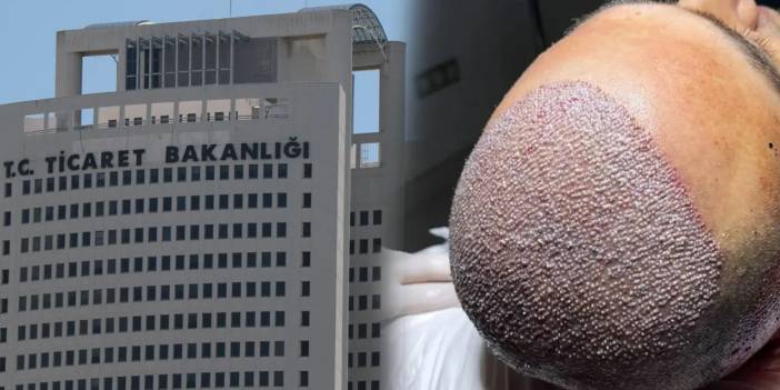 Saç çıkarma vaadi ve dini istismara ağır ceza