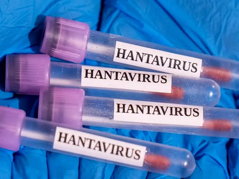 hantavirus4.webp