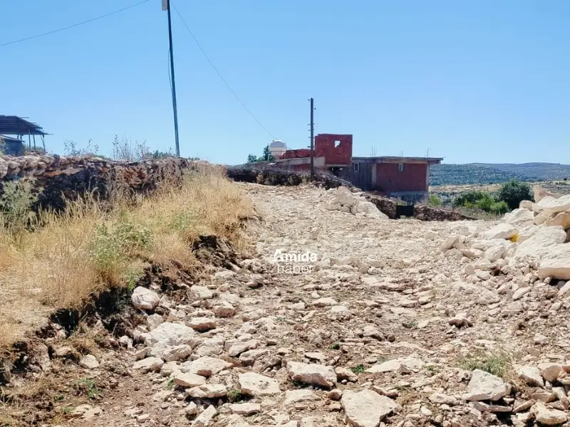 kemoterapi-hastasi-ambulansa-ulasamadi4.webp